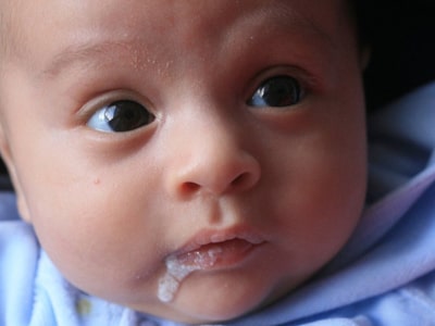 Refluxo em bebês prematuros, quais são as recomendações e dicas.